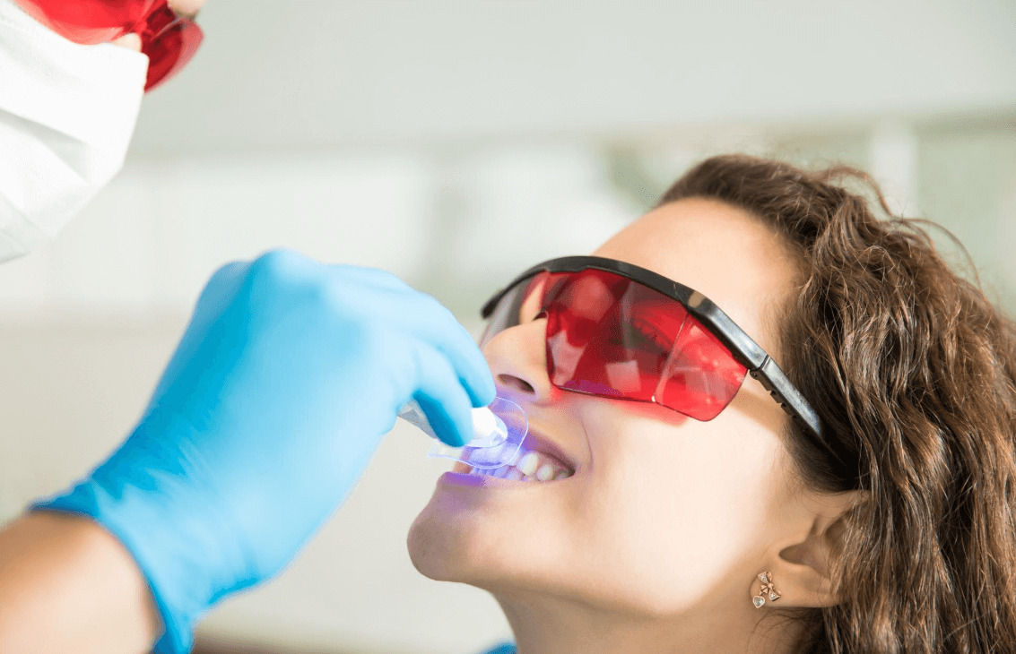 Blanqueamiento de Dientes: Precios en México 2025